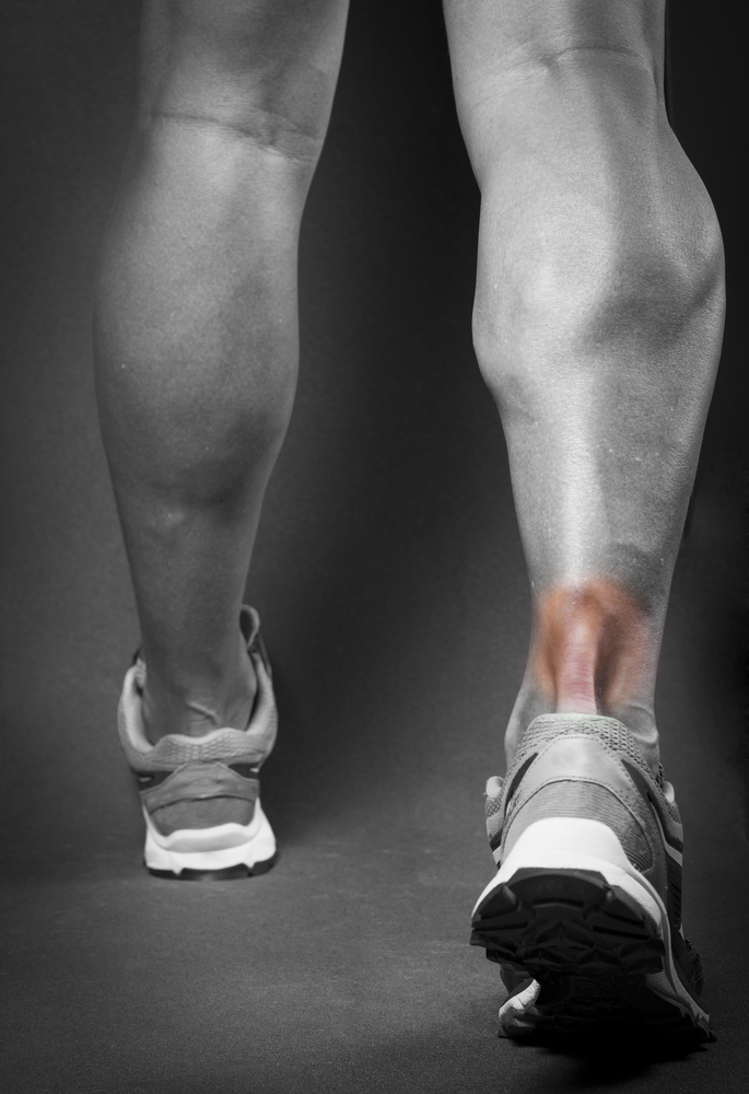 Achilles Tendonitis on Runner