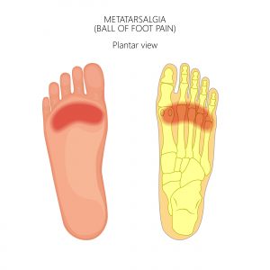 Sharp pain in ball of outlet foot