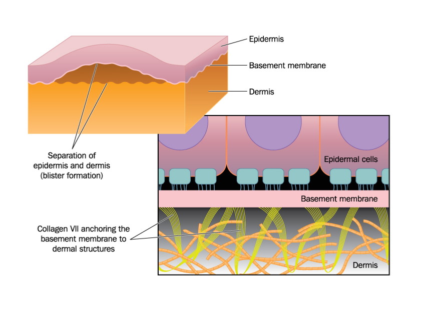 Causes Treatment and Prevention of Blisters Caruso Foot and Ankle