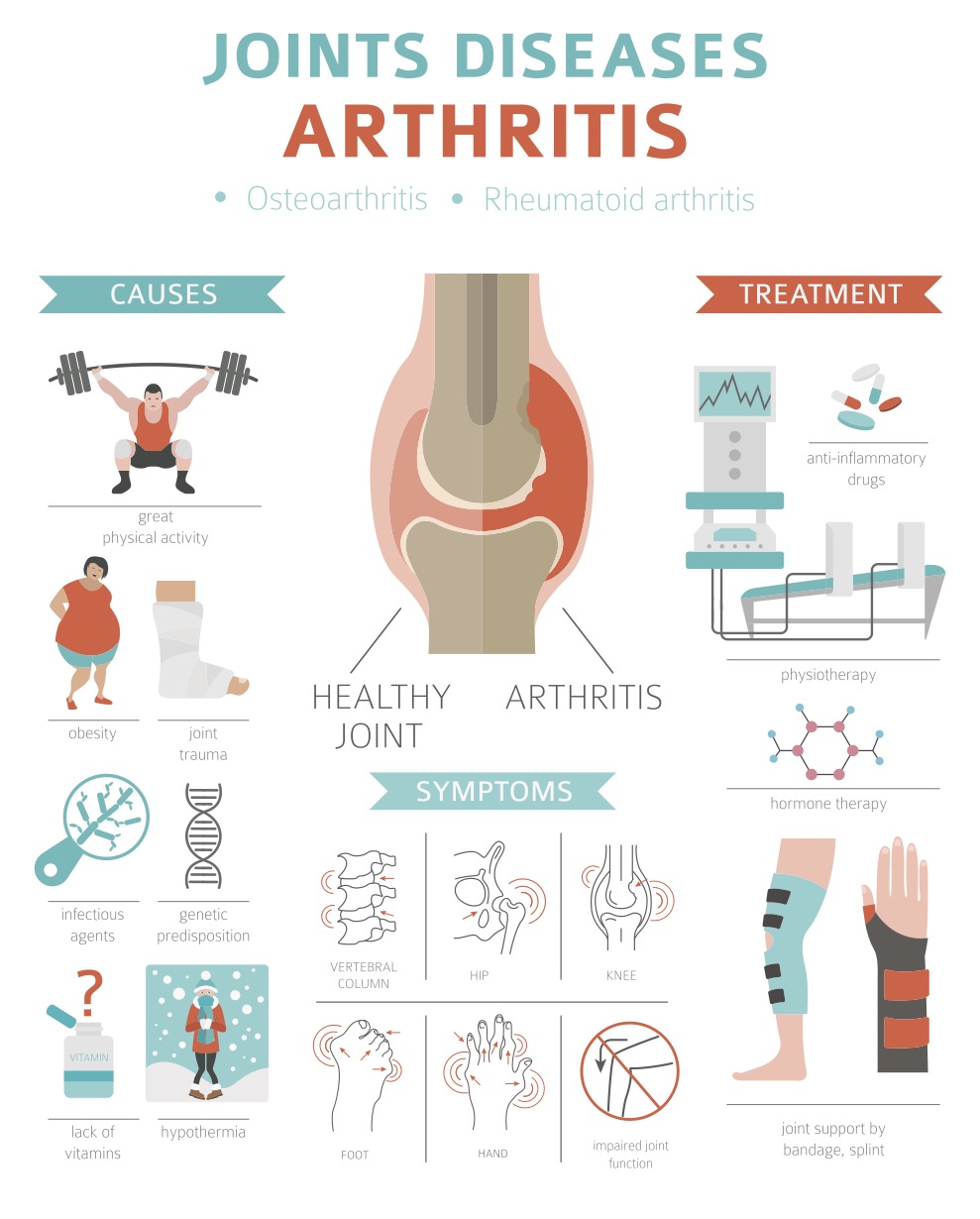 Info graph of arthritis - causes, treatment, and symptoms